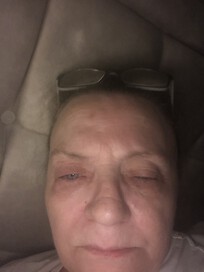 My eyes are so painful is there different medication she can give me instead of these that do nothing hope you all keep strong love Donna xxx