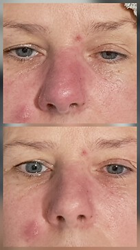 Before and after.