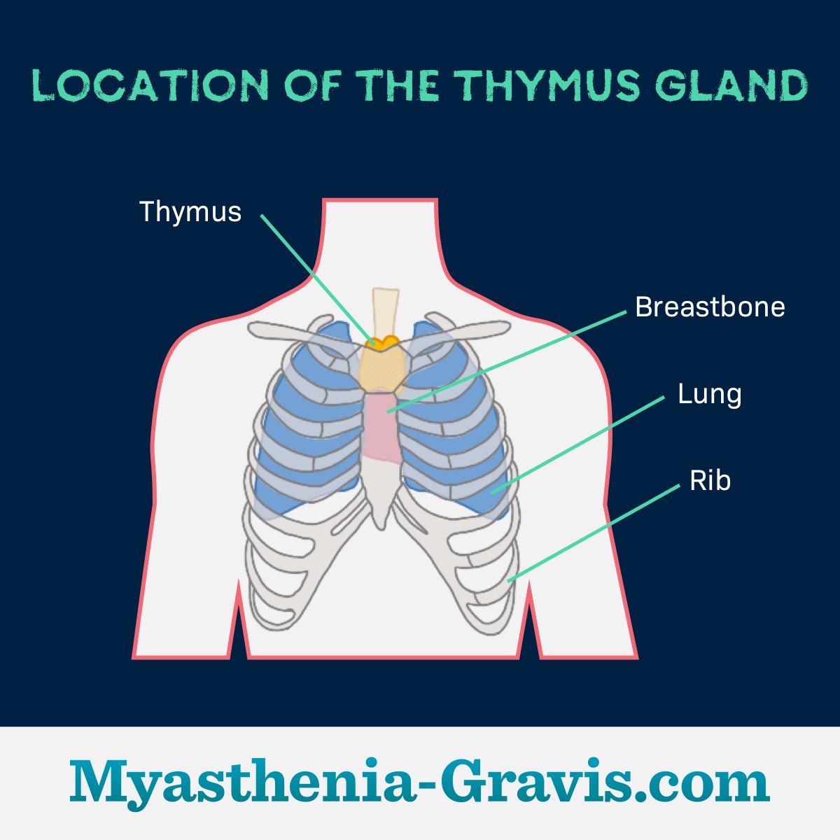 Diagram of human chest showing the thymus, breastbone, lung, and ribs.