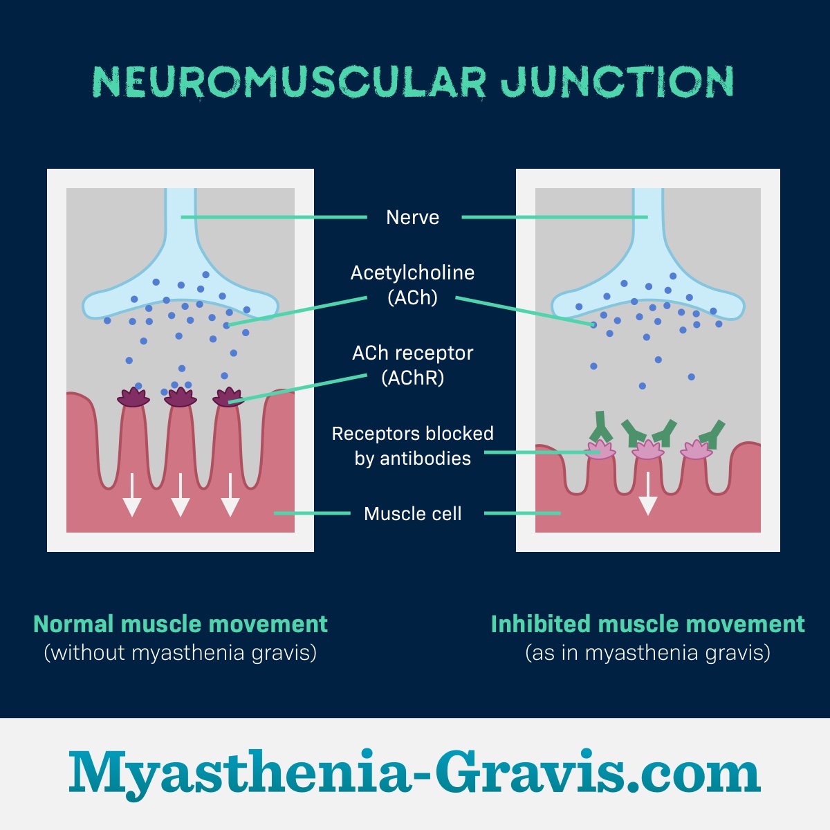 acetylcholine receptor myasthenia gravis