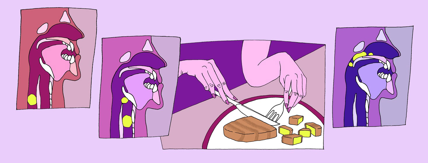 pictures of someone cutting up food with myasthenia gravis and problems swallowing