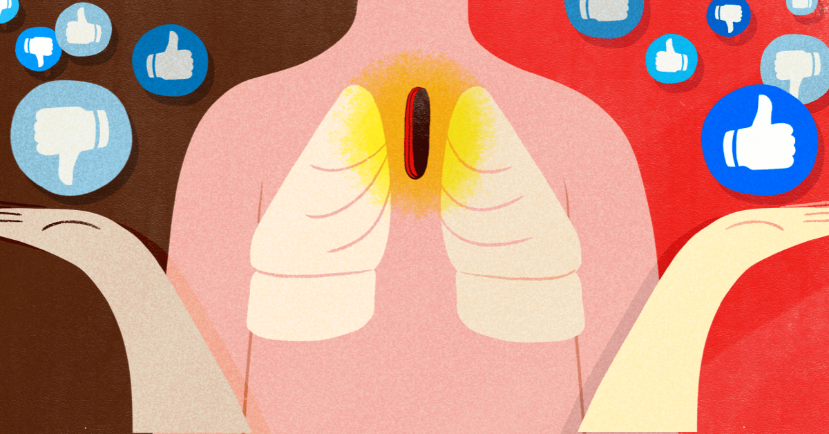 Having a Thymectomy for Myasthenia Gravis